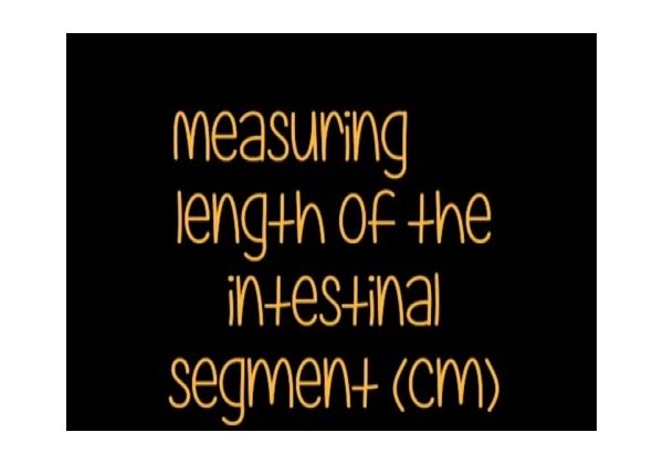 10a Single Pass Intestinal Perfusion